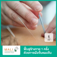 ฟื้นฟูร่างกาย ด้วยการฝังเข็มแผนจีน TCM REHAB 1 ครั้ง