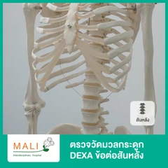 ตรวจวัดมวลกระดูก DEXA ข้อต่อสันหลังแต่ละข้อ (IVA)