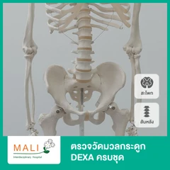 โปรแกรมตรวจวัดมวลกระดูก DEXA ครบชุด สะโพก 2 ข้าง กระดูกสันหลัง และข้อต่อสันหลังแต่ละข้อ