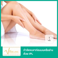 กำจัดขนขาท่อนบนหรือล่าง ด้วย IPL 1 ครั้ง