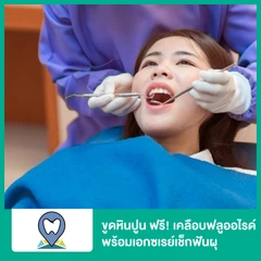 ขูดหินปูน ฟรี! เคลือบฟลูออไรด์ พร้อมเอกซเรย์เช็กฟันผุ