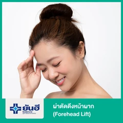 ดึงหน้าผาก รวมแก้หว่างคิ้ว (Forehead Lift)