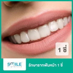 รักษารากฟันหน้า 1 ซี่