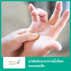ผ่าตัดรักษาอาการนิ้วล็อค แบบแผลเล็ก (Percutaneous Trigger Finger Release)