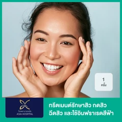 Acne Treatment ทรีตเมนต์รักษาสิวด้วยการกดสิว ฉีดสิว และใช้อินฟราเรดสีฟ้า 1 ครั้ง