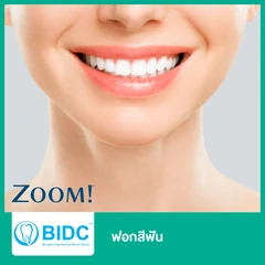 ฟอกสีฟัน ด้วยระบบ Zoom