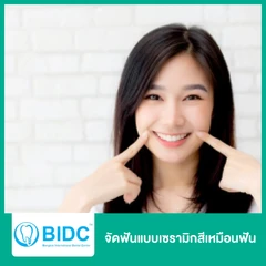 จัดฟันแบบเซรามิกสีเหมือนฟัน