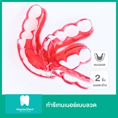 ทำรีเทนเนอร์แบบลวด 2 ชิ้น ฟันบนและล่าง