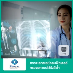 ตรวจเอกซเรย์คอมพิวเตอร์ทรวงอกแบบใช้รังสีต่ำ (Low-Dose CT)