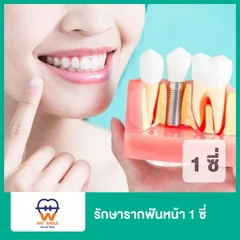 รักษารากฟันหน้า 1 ซี่