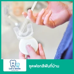 ชุดฟอกสีฟันที่บ้าน