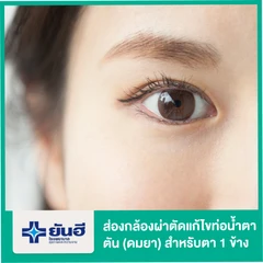 ส่องกล้องผ่าตัดท่อน้ำตาตัน สำหรับตา 1 ข้าง (ดมยา)