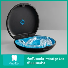จัดฟันแบบใส Invisalign Lite ฟันบนและล่าง