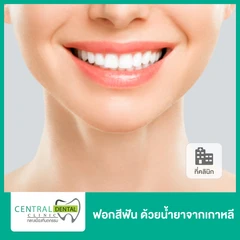 ฟอกสีฟันที่คลินิก ด้วยระบบ Cool Light น้ำยาจากเกาหลี