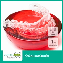 ทำรีเทนเนอร์แบบใส 1 ชิ้น ฟันบนหรือล่าง