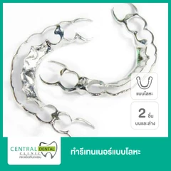 ทำรีเทนเนอร์แบบโลหะ 2 ชิ้น ฟันบนและล่าง