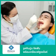 ขูดหินปูน ขัดฟัน พร้อมเคลือบฟลูออไรด์