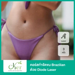 คอร์สกำจัดขน Brazilian ด้วย Diode Laser 3 ครั้ง ภายใน 3 เดือน สำหรับผู้หญิง