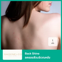 Back Shine ลดรอยสิวบริเวณหลัง 1 ครั้ง