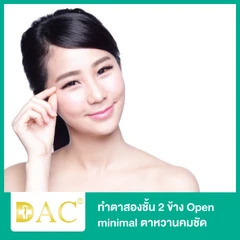 ทำตาสองชั้น 2 ข้าง Open minimal ตาหวานคมชัด สำหรับเคสทำครั้งแรก