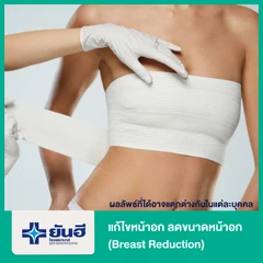แก้ไขหน้าอกหย่อนยาน เพื่อลดขนาดหน้าอก (Breast Reduction)