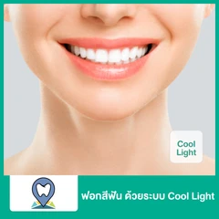 ฟอกสีฟัน ด้วยระบบ Cool Light