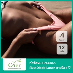 คอร์สกำจัดขน Brazilian ด้วย Cool 3 Wavelength Diode Laser 12 ครั้ง ภายใน 1 ปี สำหรับผู้หญิง ที่ Cher Clinic