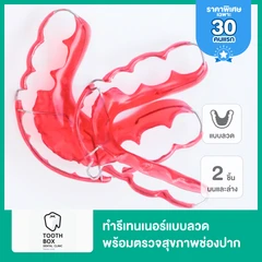ทำรีเทนเนอร์แบบลวด 2 ชิ้น ฟันบนและล่าง พร้อมตรวจสุขภาพช่องปาก