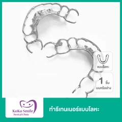 ทำรีเทนเนอร์แบบโลหะ 1 ชิ้น ฟันบนหรือล่าง