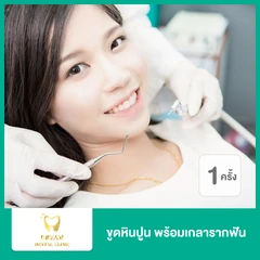 ขูดหินปูนพร้อมเกลารากฟัน 1 ครั้ง