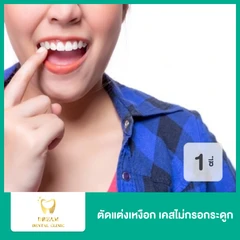 ตัดแต่งเหงือก เคสไม่กรอกระดูก สำหรับฟัน 1 ซี่