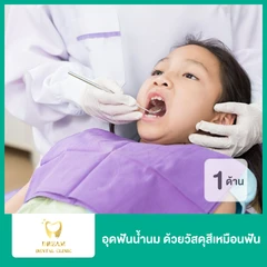 อุดฟันน้ำนม ฟันหน้า 1 ด้าน ด้วยวัสดุสีเหมือนฟัน