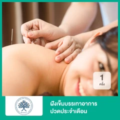 ฝังเข็มบรรเทาอาการปวดประจำเดือน 1 ครั้ง