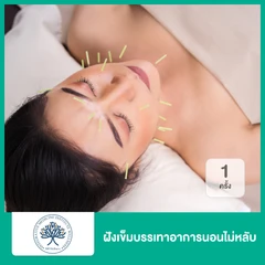 ฝังเข็มบรรเทาอาการนอนไม่หลับ 1 ครั้ง