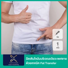 ฉีดเติมไขมันบริเวณอวัยวะเพศชาย ด้วยเทคนิค Fat Transfer 1 ครั้ง