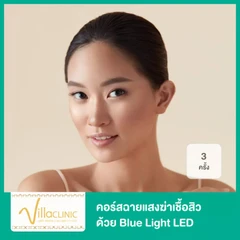 คอร์สฉายแสงฆ่าเชื้อสิว ด้วย Blue Light LED 3 ครั้ง