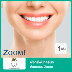 ฟอกสีฟันที่คลินิก ด้วยระบบ Zoom 1 ครั้ง
