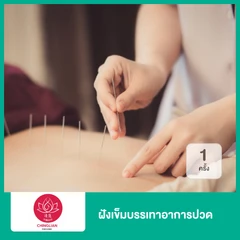 ฝังเข็มบรรเทาอาการปวด 1 ครั้ง