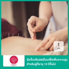 ฝังเข็มปรับฮอร์โมนเพื่อเพิ่มความสูง สำหรับผู้ที่อายุ 15 ปีขึ้นไป 1 ครั้ง