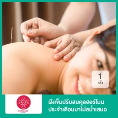 ฝังเข็มปรับสมดุลฮอร์โมนเพศหญิง ประจำเดือนมาไม่สม่ำเสมอ 1 ครั้ง