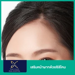 เสริมหน้าผากด้วยซิลิโคนสำเร็จรูป