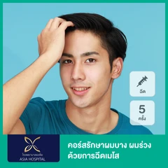คอร์สรักษาผมบาง ผมร่วง ด้วยการฉีดเมโส 5 ครั้ง