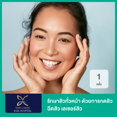 รักษาสิวทั่วหน้า ด้วยการกดสิว ฉีดสิว เลเซอร์สิว 1 ครั้ง