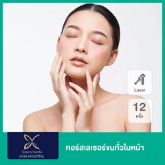 คอร์สเลเซอร์ขนทั่วใบหน้า ด้วย SHR Laser 12 ครั้ง
