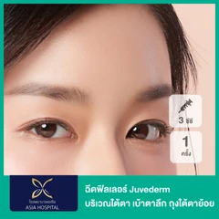 โปรแกรมฟิลเลอร์ 3 ซีซี (ใต้ตา)