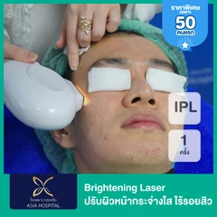 Brightening Laser ทำ IPL ปรับผิวหน้ากระจ่างใส ไร้รอยสิว ฝ้า กระ จุดด่างดำ 1 ครั้ง