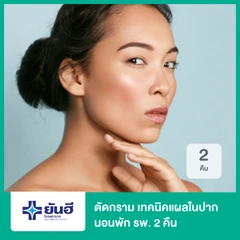 ตัดกราม เทคนิคแผลในช่องปาก พักฟื้นรพ. 2 คืน