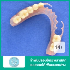 ทำฟันปลอมโครงพลาสติก แบบถอดได้ ฟันบนและล่างอย่างละ 14 ซี่