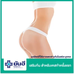 เสริมก้น ด้วยซิลิโคน Motiva สำหรับเคสทำครั้งแรก