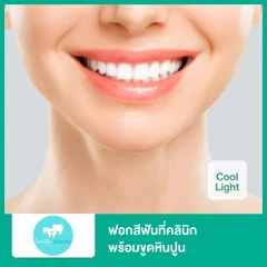 ฟอกสีฟันที่คลินิก ด้วยระบบ Cool Light พร้อมขูดหินปูน